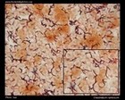clostridium ramosum micrograph